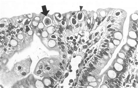  Isospora! A Tiny Terror That Lurks Within Our Furry Friends