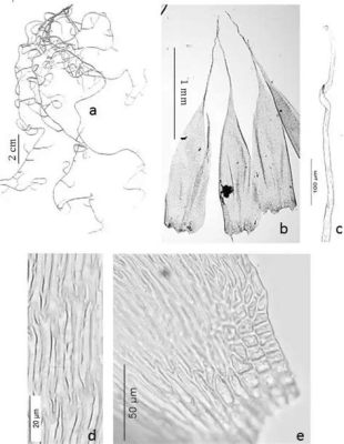  Keen-Eyed Kallipalpia: Unveiling the Fascinating Secrets of a Polychaete Pioneer!